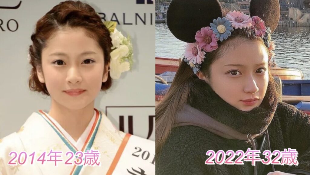 整形疑惑の小澤美里