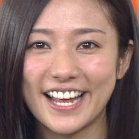 木村文乃のアトピー性皮膚炎の時の画像